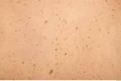 Photo Textures of Human Skin